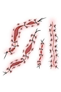 Tattoo: Thread Stitch