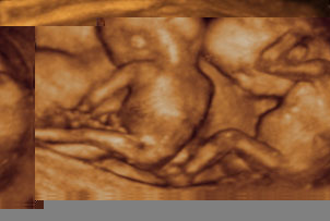 Unbranded Ultrasound Babyscan